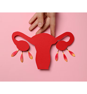 Endometriose
